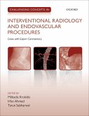 Challenging Concepts in Interventional Radiology (eBook, PDF)