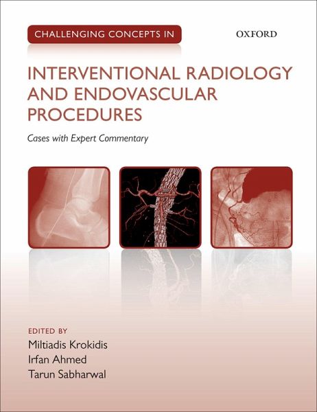 Challenging Concepts in Interventional Radiology (eBook, PDF) Challenging Concepts in Interventional Radiology (eBook, PDF)