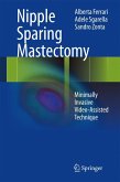 Nipple Sparing Mastectomy (eBook, PDF)