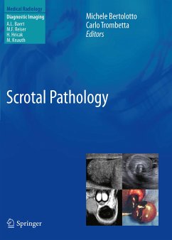 Scrotal Pathology (eBook, PDF)