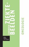 Zakboek ziektebeelden Oncologie (eBook, PDF)