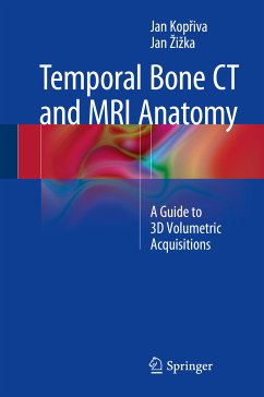 Temporal Bone CT and MRI Anatomy (eBook, PDF) - Kopřiva, Jan; Žižka, Jan