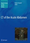 CT of the Acute Abdomen (eBook, PDF)