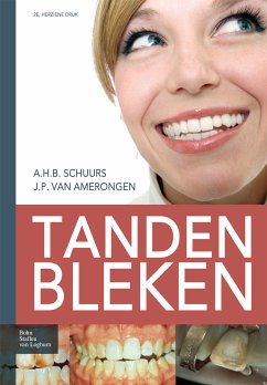 Tanden bleken (eBook, PDF) - Schuurs, A.H.B.; van Amerongen, J.P.