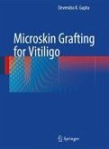Microskin Grafting for Vitiligo (eBook, PDF)
