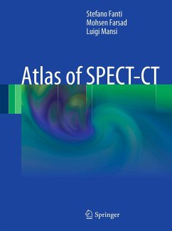 Atlas of SPECT-CT (eBook, PDF) - Fanti, Stefano; Farsad, Mohsen; Mansi, Luigi