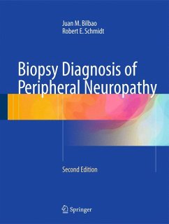 Biopsy Diagnosis of Peripheral Neuropathy (eBook, PDF) - Bilbao, Juan M; Schmidt, Robert E