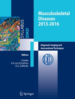 Musculoskeletal Diseases 2013-2016 (eBook, PDF) - Hodler, J.
