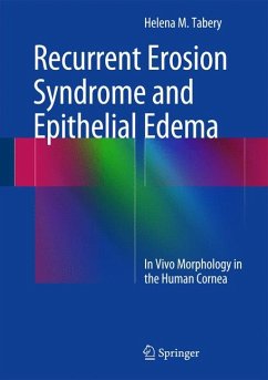 Recurrent Erosion Syndrome and Epithelial Edema (eBook, PDF) - Tabery, Helena M.