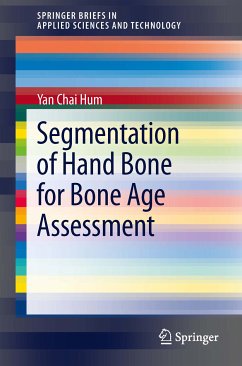 Segmentation of Hand Bone for Bone Age Assessment (eBook, PDF) - Hum, Yan Chai