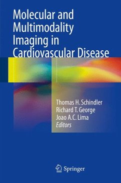 Molecular and Multimodality Imaging in Cardiovascular Disease (eBook, PDF)