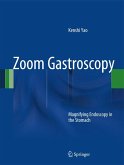 Zoom Gastroscopy (eBook, PDF)