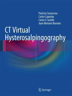 CT Virtual Hysterosalpingography (eBook, PDF) - Carrascosa, Patricia; Capuñay, Carlos; Sueldo, Carlos E.; Baronio, Juan Mariano