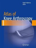 Atlas of Knee Arthroscopy (eBook, PDF)