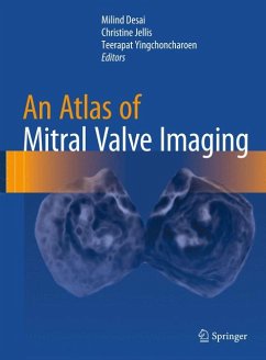An Atlas of Mitral Valve Imaging (eBook, PDF)