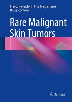 Rare Malignant Skin Tumors (eBook, PDF) - Rongioletti, Franco; Margaritescu, Irina; Smoller, Bruce R