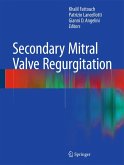 Secondary Mitral Valve Regurgitation (eBook, PDF)