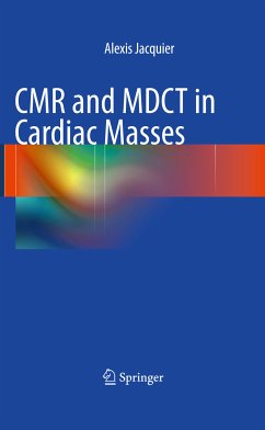 CMR and MDCT in Cardiac Masses (eBook, PDF) - Jacquier, Alexis