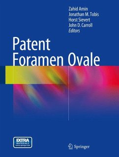 Patent Foramen Ovale (eBook, PDF)