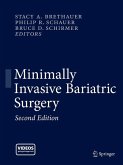 Minimally Invasive Bariatric Surgery (eBook, PDF)