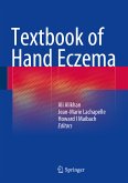 Textbook of Hand Eczema (eBook, PDF)