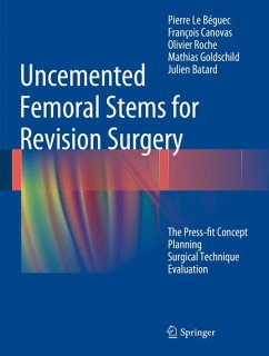 Uncemented Femoral Stems for Revision Surgery (eBook, PDF) - Le Béguec, Pierre; Canovas, François; Roche, Olivier; Goldschild, Mathias; Batard, Julien