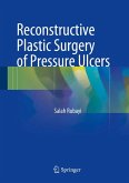 Reconstructive Plastic Surgery of Pressure Ulcers (eBook, PDF)