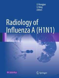 Radiology of Influenza A (H1N1) (eBook, PDF)