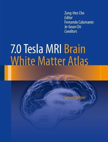 7.0 Tesla MRI Brain White Matter Atlas (eBook, PDF) 7.0 Tesla MRI Brain White Matter Atlas (eBook, PDF)