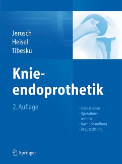 Knieendoprothetik (eBook, PDF) - Jerosch, Jörg; Heisel, Jürgen; Tibesku, Carsten O.