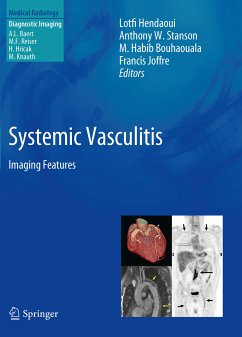 Systemic Vasculitis (eBook, PDF)