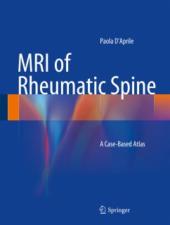 MRI of Rheumatic Spine (eBook, PDF) - D’Aprile, Paola