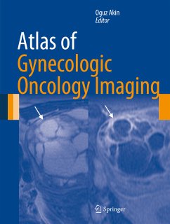 Atlas of Gynecologic Oncology Imaging (eBook, PDF)