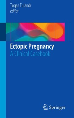 Ectopic Pregnancy (eBook, PDF)