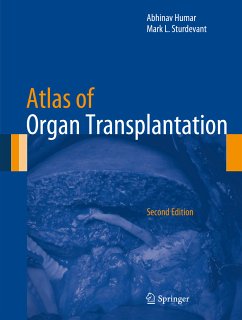 Atlas of Organ Transplantation (eBook, PDF)