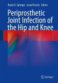 Periprosthetic Joint Infection of the Hip and Knee (eBook, PDF)