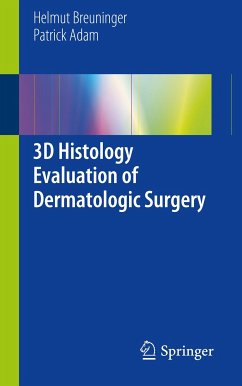 3D Histology Evaluation of Dermatologic Surgery (eBook, PDF) - Breuninger, Helmut; Adam, Patrick