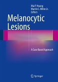 Melanocytic Lesions (eBook, PDF)