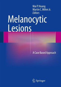 Cover Melanocytic Lesions (eBook, PDF)