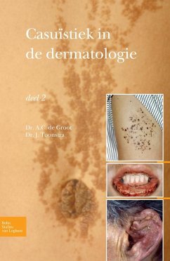 Cover Casuïstiek in de dermatologie - deel 2 (eBook, PDF)