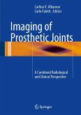 Imaging of Prosthetic Joints (eBook, PDF)