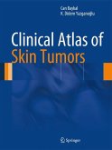 Clinical Atlas of Skin Tumors (eBook, PDF)