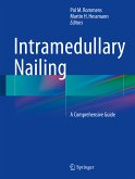 Intramedullary Nailing (eBook, PDF)