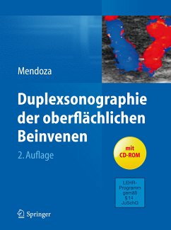 Duplexsonographie der oberflächlichen Beinvenen (eBook, PDF) - Mendoza, Erika