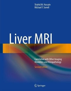 Liver MRI (eBook, PDF) - Hussain, Shahid M.; Sorrell, Michael F.