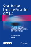 Small Incision Lenticule Extraction (SMILE) (eBook, PDF)