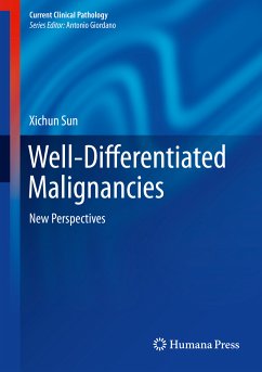 Well-Differentiated Malignancies (eBook, PDF) - Sun, Xichun