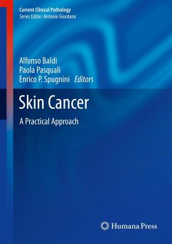 Skin Cancer (eBook, PDF)