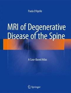 MRI of Degenerative Disease of the Spine (eBook, PDF) - D'Aprile, Paola