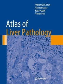 Cover Atlas of Liver Pathology (eBook, PDF)